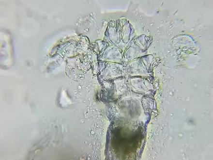 什么是螨虫?#科普 #显微镜下的世界 #螨虫@DOU+小助手