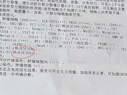 男子肩背部长肿物四个多月,外院B超检查认为是脂肪瘤,手术切除后病理提示恶性肿瘤,我院会诊确认病变符合尤文肉瘤,需尽快接受全身治疗。#新年囤点专业货 #复工健康指南 #尤文肉瘤 #肉瘤 #骨肿瘤科沈靖南