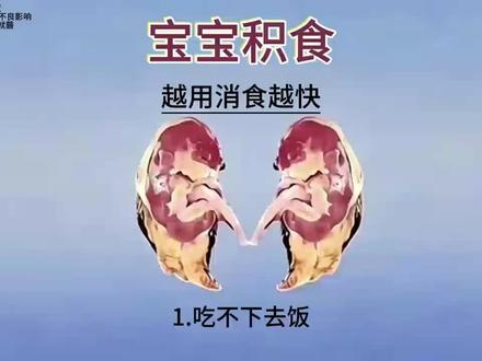 宝宝积食,其实很简单 #宝宝积食 #育儿小妙招 #分享 #消食贴