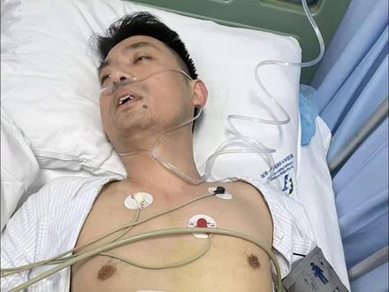 #胆囊结石 发病率很高,据说占总人口13%,有哪些做了#胆囊切除 的呢?痛!遭罪!还花了我一万多大洋😭!你们呢?