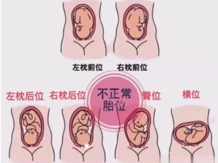 如何在B超单上看胎宝宝胎位#孕期 #孕期知识 #怀孕 #孕期记录 #孕晚期