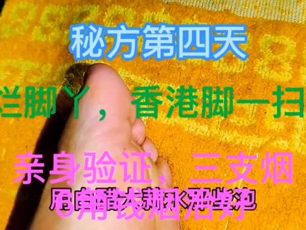 6角钱治好烂脚丫香港脚