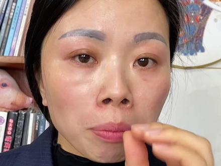 真心劝大家,不要反复折腾眉毛!
一次次改眉、洗眉、补色、重做,
不断刺激眉部皮肤,直接损伤毛孔和毛囊。
毛囊一旦受损萎缩,就再也无法正常生长眉毛。后期眉毛越来越稀疏、甚至永久不长,再想养出原生野生眉,根本来不及。
变美别拿眉毛健康做代价,
少过度改造,好好爱护#个人护理心得 #美业 #眉毛