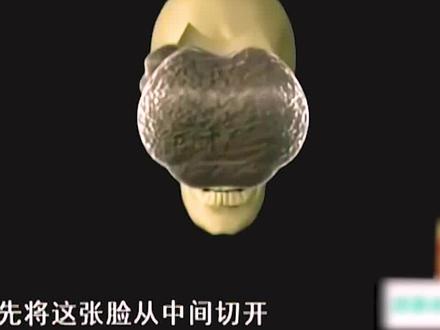 马脸女孩蒙脸生活13年,医生掀开盖头被吓到,最终手术成功。#纪实 #纪实故事 #社会百态 #社会百态真实事件 #医者