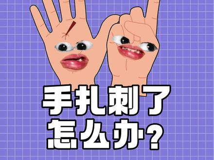以后手上扎刺了千万不要用针去挑哦 #扎刺 #生活小妙招 #实用小技巧