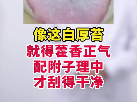 像这白厚苔,就得藿香正气配附子理中才刮得干净 #健康科普 #中医 #硬核健康科普行动 #抖出健康知识宝藏