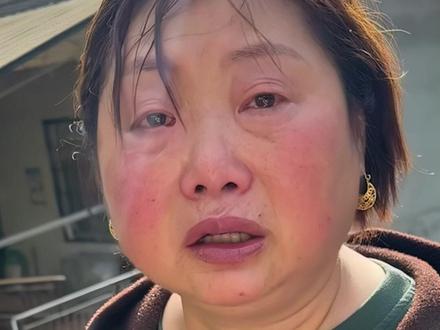 “我只关心村民的事。”湖南石门救灾女干部向金元因佩戴耳环遭少数网友质疑。她回应,耳环网购不到100元,比起这些,她更关心村民安置、房屋受损和庄稼情况。
