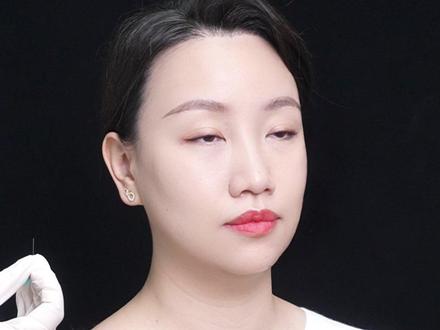 玉女十三针教程:不垮脸密码!谁做谁年轻 #中国中医科学院 #面部针灸美容 #中医美容去哪里学 #是缪院啊 #玉女十三针