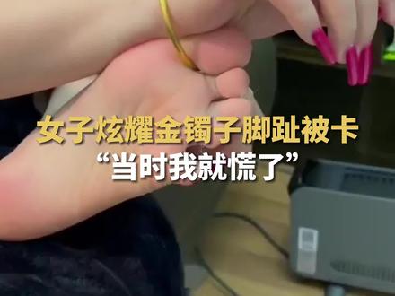 女子炫耀金镯子脚趾被卡:当时我就慌了