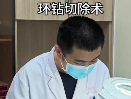 #手术 面部色素痣环钻切除#医生 #色素痣