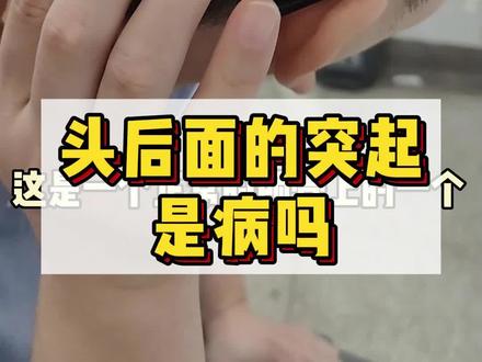 后脑勺的突起是病吗?#枕外隆突 #颅骨 #头痛 #反骨 #三国
