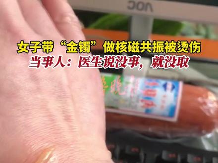 女子戴“金镯”做核磁共振被烫伤:医生说没事,就没有取。