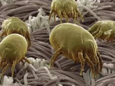 螨虫小百科 你的身上也有的。#螨虫 #螨虫