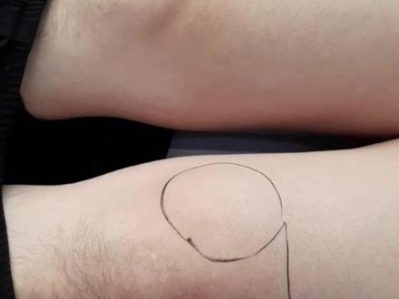 一杯啤酒惹的祸,关节肿痛难行走#中医 #健康 #膝关节 #啤酒 #越茂健康