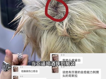 当亚b做CT扫描…… #亚b #抽象 #涩谷辣妹