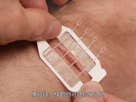 国外发明拉链创可贴,左右一拉就能缝合伤口,你知道原理吗? #科技 #创意