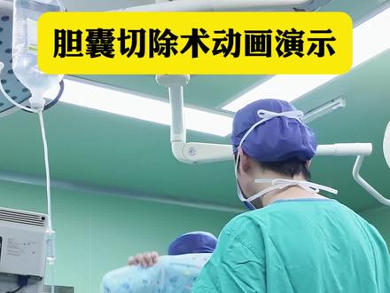 得了胆囊结石准备手术的朋友,不知道手术是怎么做的,那么这条视频能让你简单的了解#胆囊结石 #单孔腹腔镜 #胆囊切除 #单孔腹腔镜胆囊切除术
