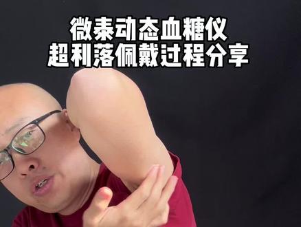 #创业灵感 微泰动态血糖仪的超利落佩戴过程分享