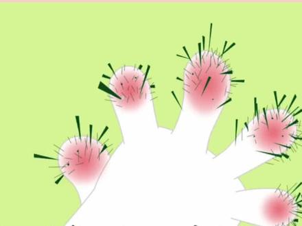 #dou上热门 小朋友被仙人掌扎伤,该怎么做呢#抖音安全课堂 #幼儿安全教育 #父母必看系列 #二次元 @DOU+小助手