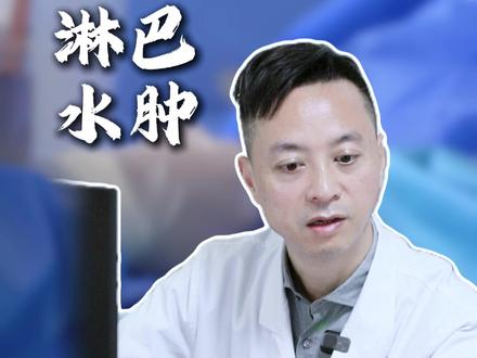 淋巴水肿患者 日常饮食建议#淋巴水肿 #淋巴水肿案例 #血管外科何春水