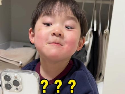 《镜头问题》 #薯条的小小世界