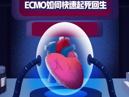 呼吸与心跳停止了,看“续命神器”ECMO如何快速起死回生 #ECMO #ecmo体外循环机 #ICU #医学科普 #专业的事交给专业的人
