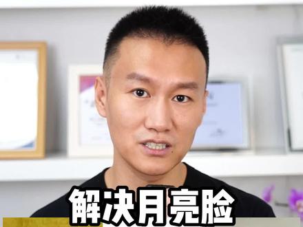 解决月亮脸,记住这4点!#月亮脸 #颜值分析 #抗衰老