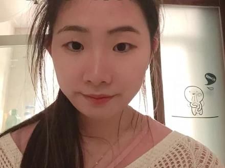 所有人都能学会! 不怕戳伤眼球的摘#美瞳 #隐形眼镜 方法