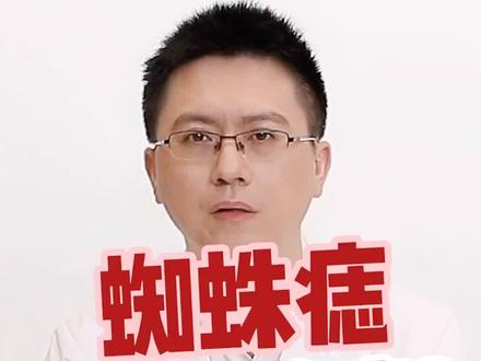 部分朋友咨询的#蜘蛛痣 #科普 来啦!到底应该如何治疗它呢?