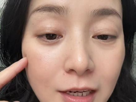 #眼袋手术 #眼袋手术前后对比 眼袋手术费用