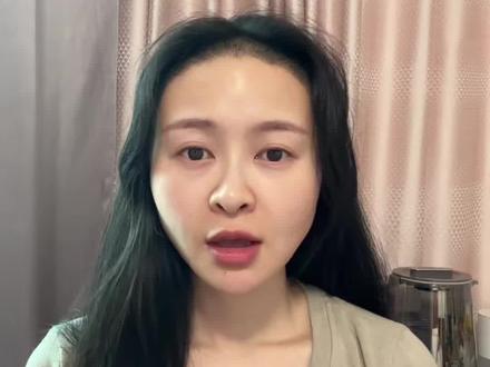 想要植发的姐妹看过来#植发科普 #专业植发 #女性植发 #毛囊移植