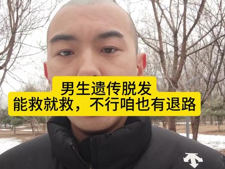 家族脱发别摆烂,. 有脱发家族史的,这条视频一定要看完#脱发怎么办 #脱发焦虑 #纹发 #假发 #脱发