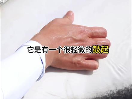 海洋公园的保育员定期会给虎鲸采血,以此全方位评估虎鲸的健康情况。虎鲸抽血怎么找血管?