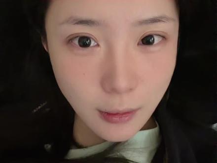 #磨骨 #磨骨改脸型 #磨骨三件套 #do脸 #磨骨后遗症
