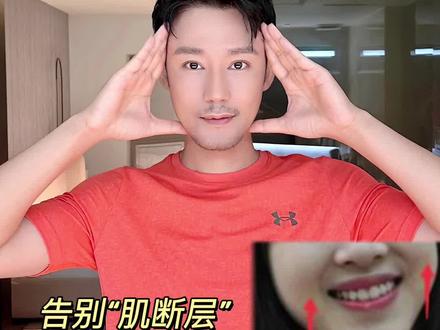 三步改善苹果肌下垂,笑肌重回年轻感
#苹果肌 #苹果肌下垂 #苹果肌提升 #抗衰老 #笑肌断层