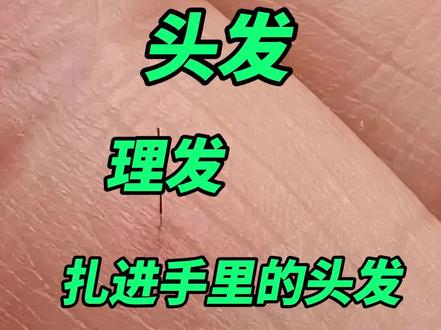 头发为什么会扎进手里?#头发 #理发师 #科普 #冷知识