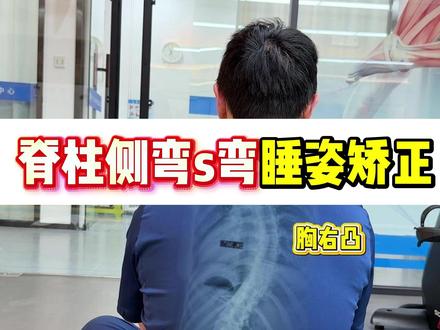 脊柱侧弯s弯,胸右凸腰左凸 ,睡姿矫正 #徐州正中脊 #脊柱侧弯 #脊柱侧弯矫正 #体态纠正 #青少年脊柱侧弯