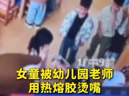 女童被幼儿园老师用热熔胶烫嘴 当地教育局通报#幼儿园