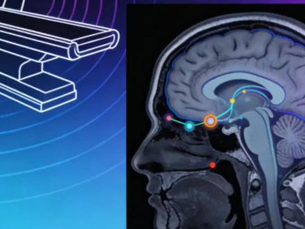 #磁共振 #辐射 #科普 #热门 #小知识
软组织肿瘤首推核磁检查。