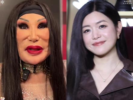 所以说,女演员还是不要轻易动脸。你看 42 岁充满熟女韵味的#陈妍希 ,出道时靠圆润苹果肌和清澈眼瞳封神的她,如今笑起来仍有少女般的神态。简直梦回那些年我们追过的女孩中,那个校花沈佳宜,而同样 40 加的林心如,却在疲惫憔悴的道路上越走越远,过度医美,被玻尿酸硬控,整个人已经抑制不住的蛮化僵硬,全然没了往日的自然舒适度。再看41岁的#张韶涵 ,巴掌大的脸配利落下颌线,年轻时被说太瘦没福气,如今却成了抗老杀手锏。岁月从不败美人在她脸上得到了具象化。反观 45 岁的萧亚轩,填充剂把唇珠撑到外翻,苹果肌对的颧骨消失,连眼神都被肿胀的眼皮压的没了神采。才发现原来真正的保鲜剂从来都不是医美冻龄,而是与岁月温柔和解的底气。但是你又会发现,最近刷到好多因为生图状态惊艳热搜的 7 0 8 0 花,都美的很自然。颖宝从发腮疲态脸到紧致剑魔脸,杨幂从原来的显老横秋到现在的少女感满满,还有蒋欣被嘲松弛的脸到如今的台演都是明眸桃花相,她们究竟是如何做到越老越年轻的?而其中的代表人物为雪无疑是最成功的,年仅 40 岁却比 20 岁的自己更显年轻态,而为雪也是毫不吝啬的在直播间分享了女明星惊艳回春的秘诀#韦雪 #面膜 #好物推荐🔥