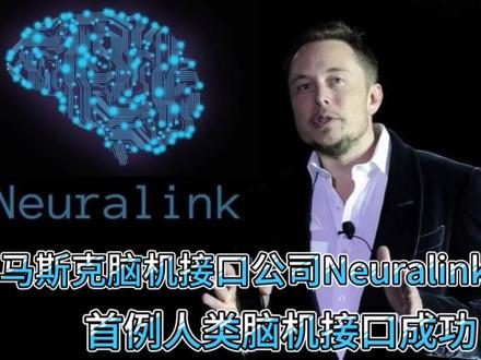 马斯克脑机接口公司Neuralink成功完成首例人类脑机植入芯片!#马斯克 #科技 #未来科技 #脑机接口 #neuralink #抖音汽车 #dou是好车 #抖音热门 #特斯拉