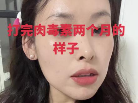 大家放心吧这个就是一个时间的问题 🤗随着时间都会代谢掉的