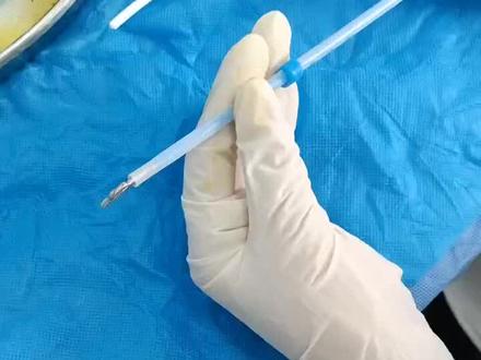 #手术室日常 #医学科普 这就是宫型环儿哦,好取好放还不贵!