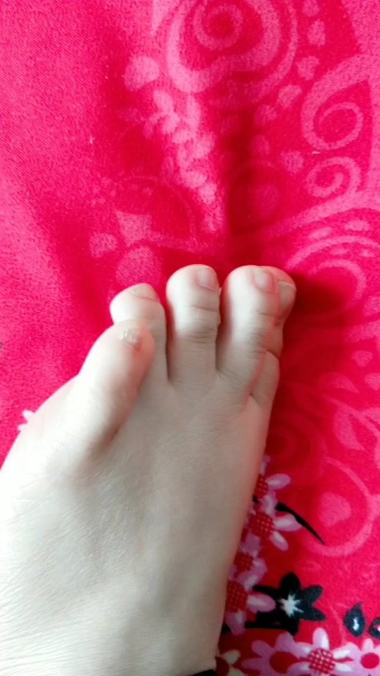 小脚趾甲小到几乎没有 - 抖音