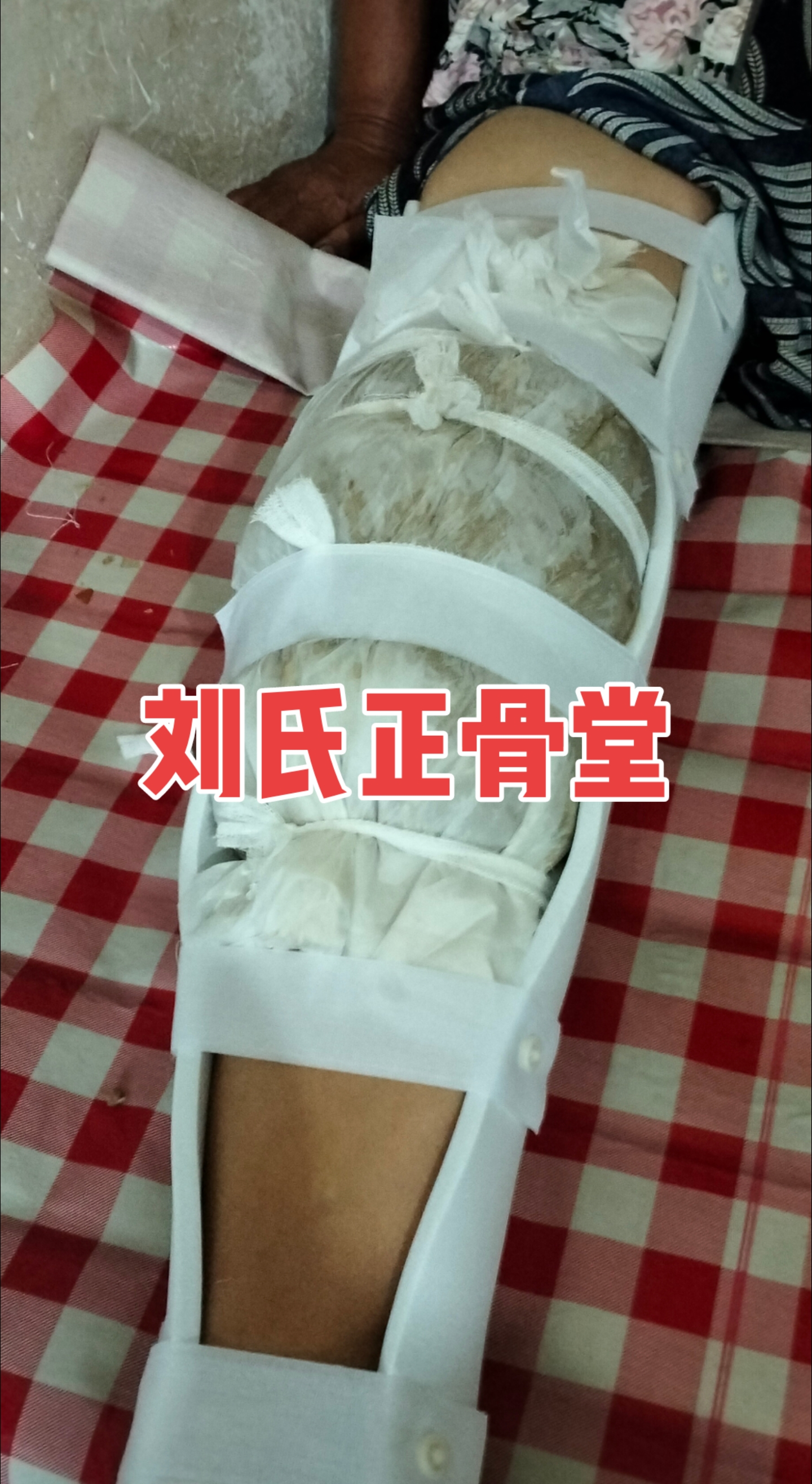 刘氏正骨堂:刘氏正骨堂.祖传接骨 刘银发