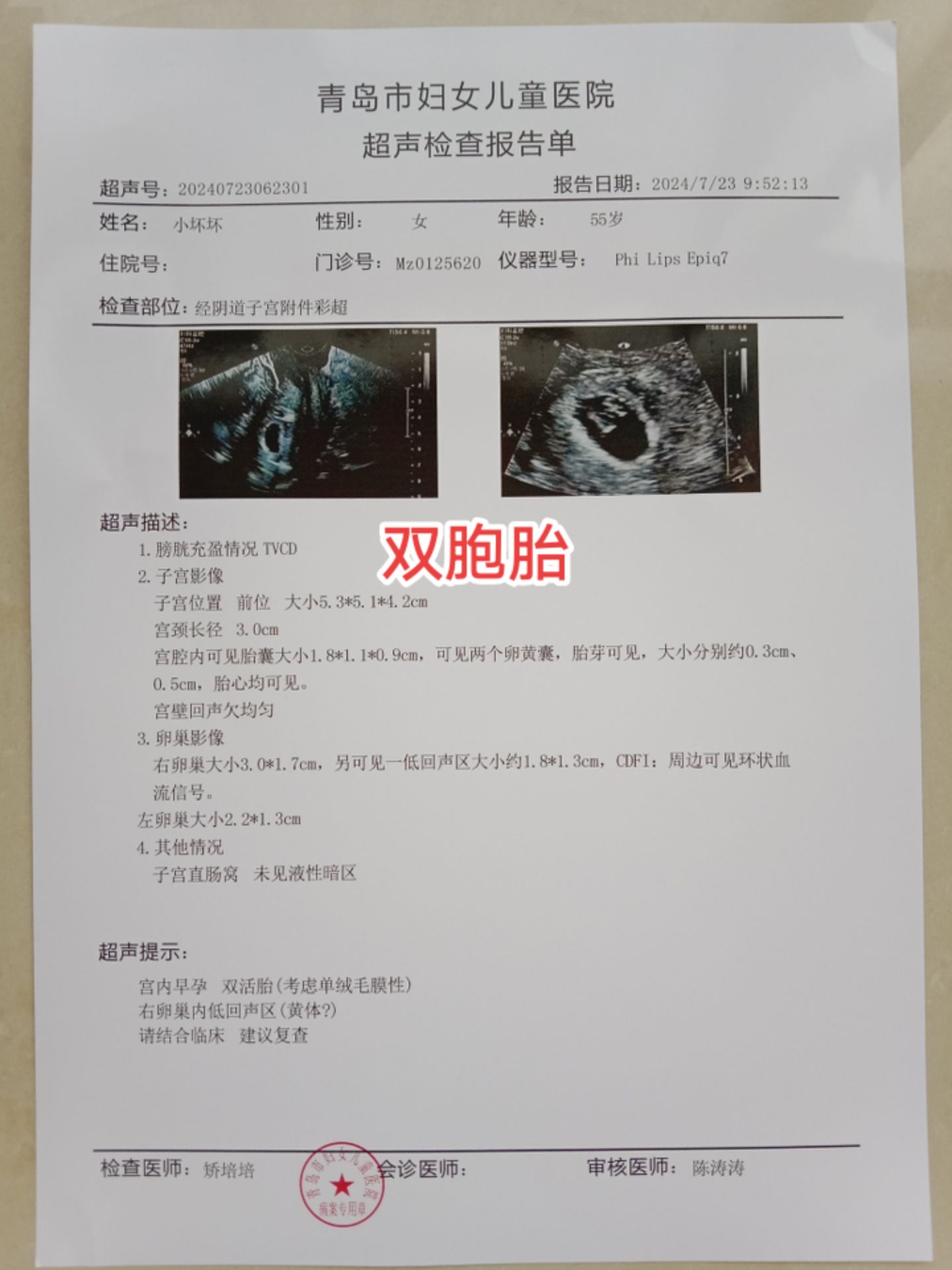 一个月的b超来找我挑衅时,我拿出我和我男友的这个双胞胎孕检b超单