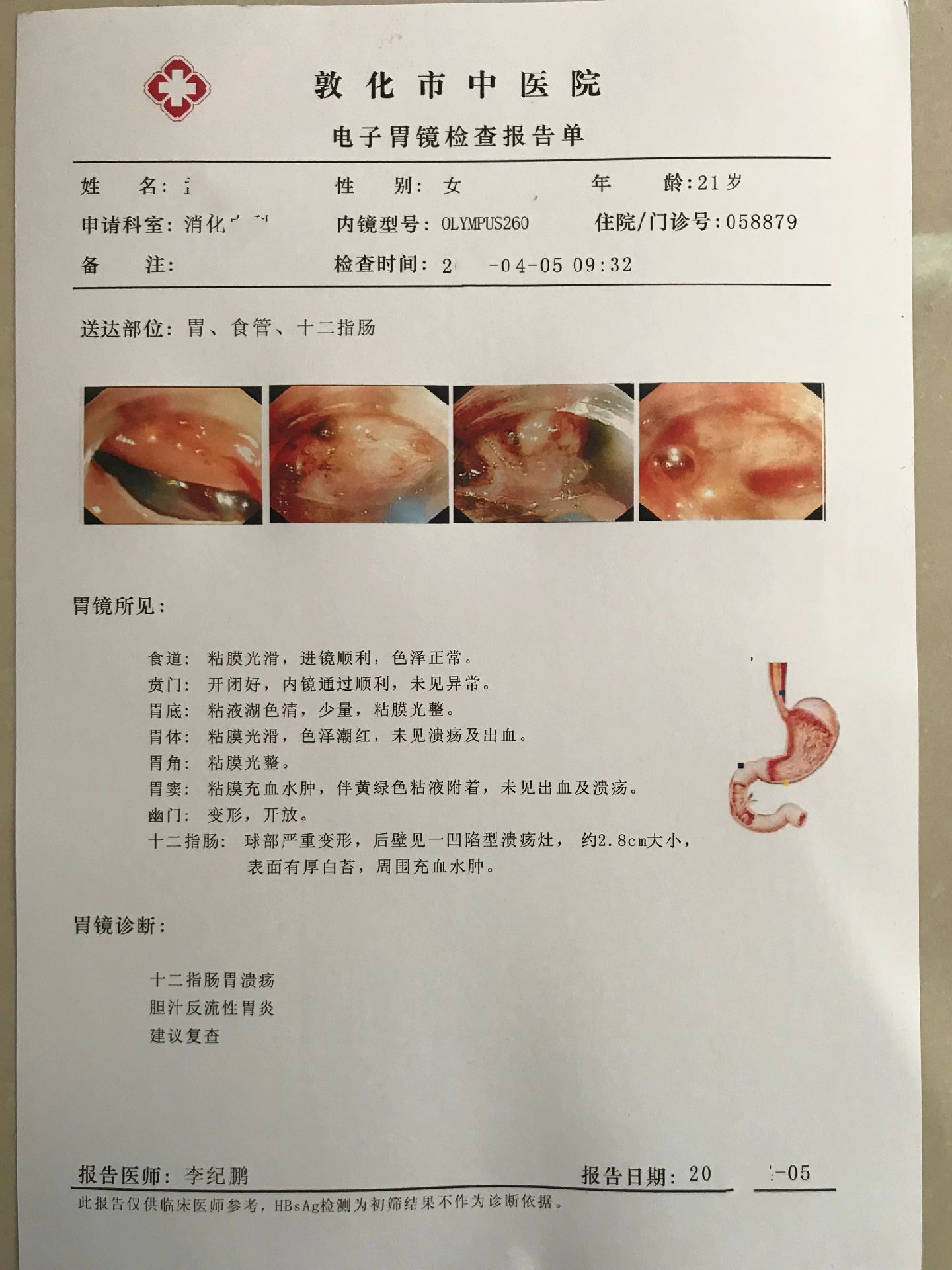 图文制作定制:图片修改名字年龄日期p图#胃溃疡#慢性胃炎#胃镜报告单