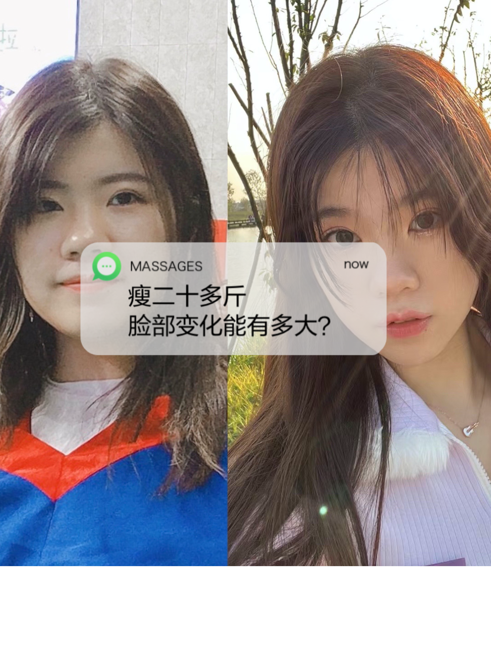 减肥后鼻子会小吗 - 抖音