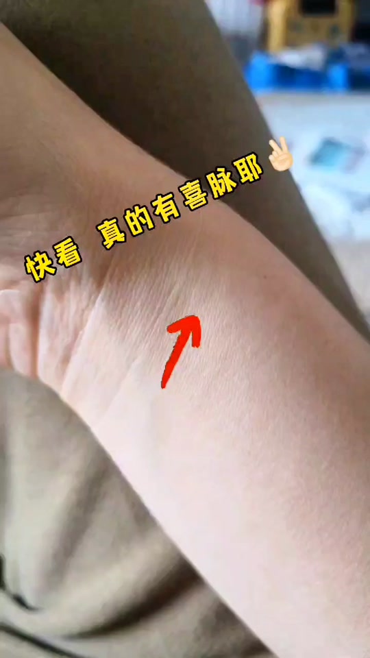 怀孕手腕脉搏跳动是真的吗 - 抖音