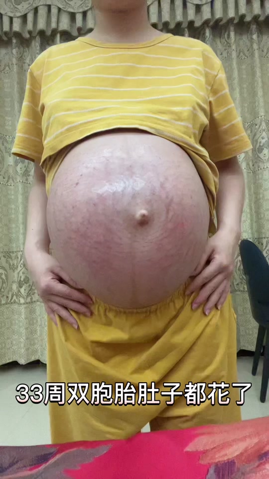 多胞胎孕妇临产巨肚 - 抖音